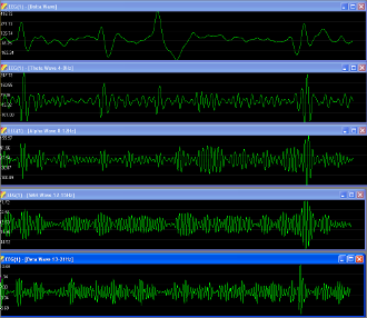 brainwaves